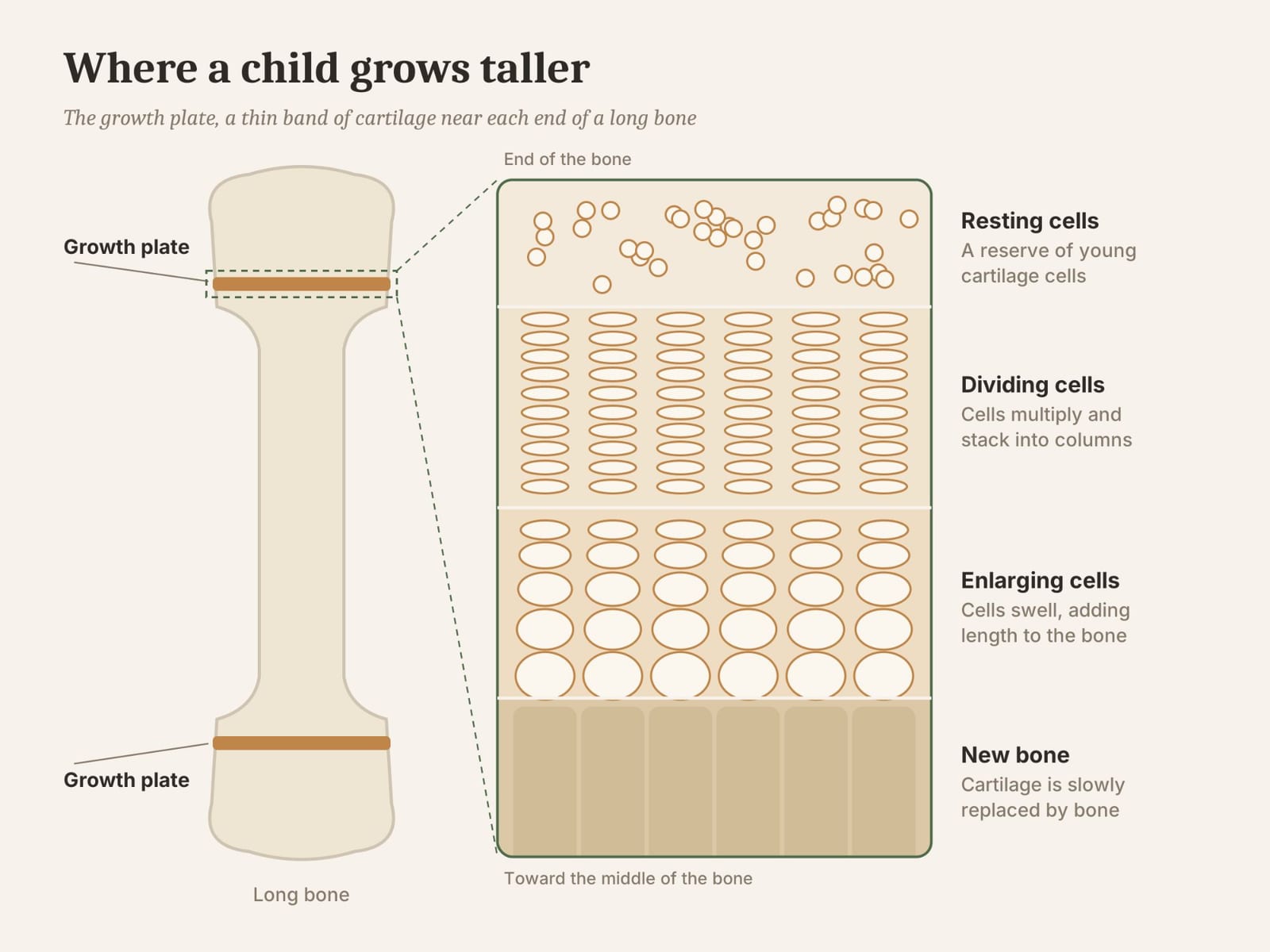 The growth plate, where a child's bones get longer